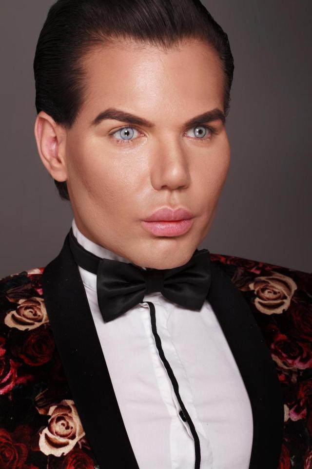  Human Ken Doll Rodrigo Alves was warned his nose could 'turn black and fall off'