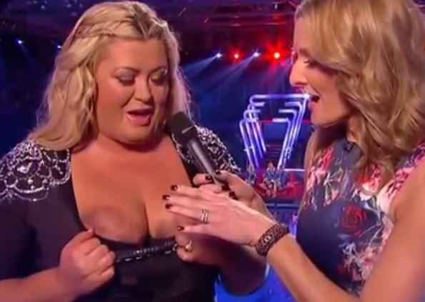  Gemma revealed she had badly bruised her boobs before diving in Splash