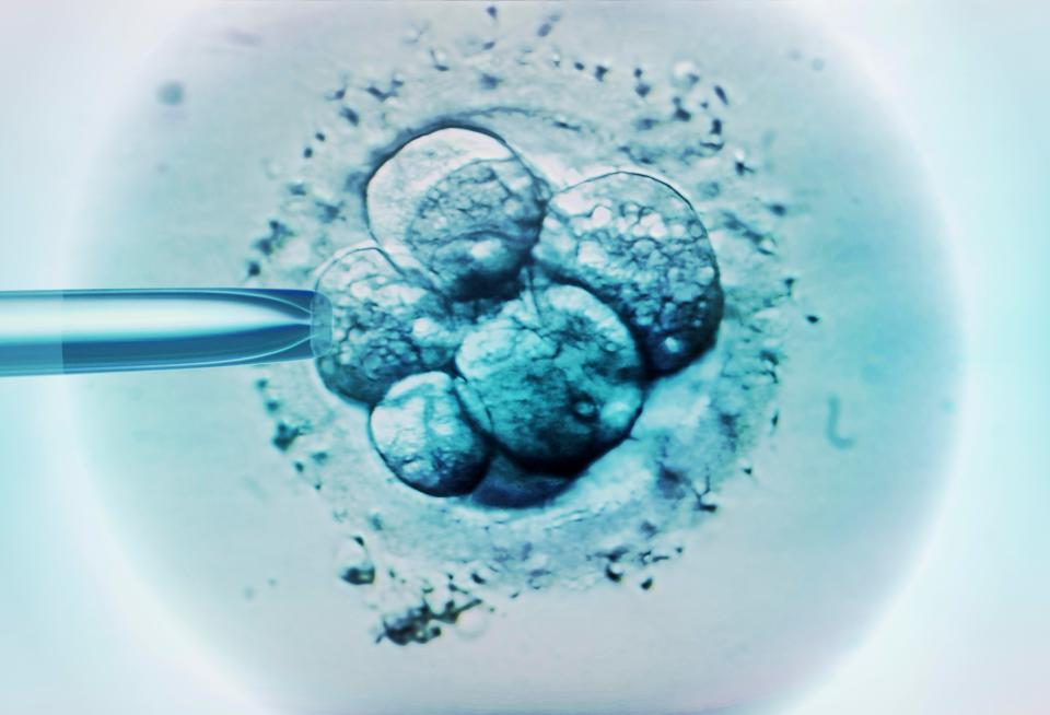  Costs can vary depending on the clinic, but one cycle of IVF can be up to £5,000 or more