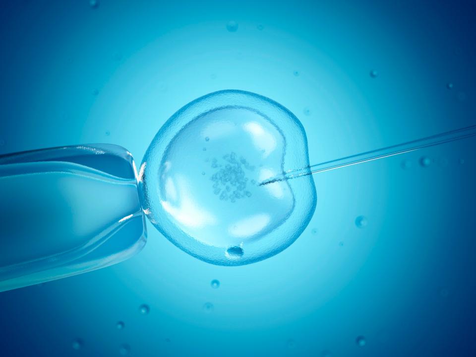  The IVF process involves removing an egg from a woman’s ovaries and fertilising them using sperm in a laboratory