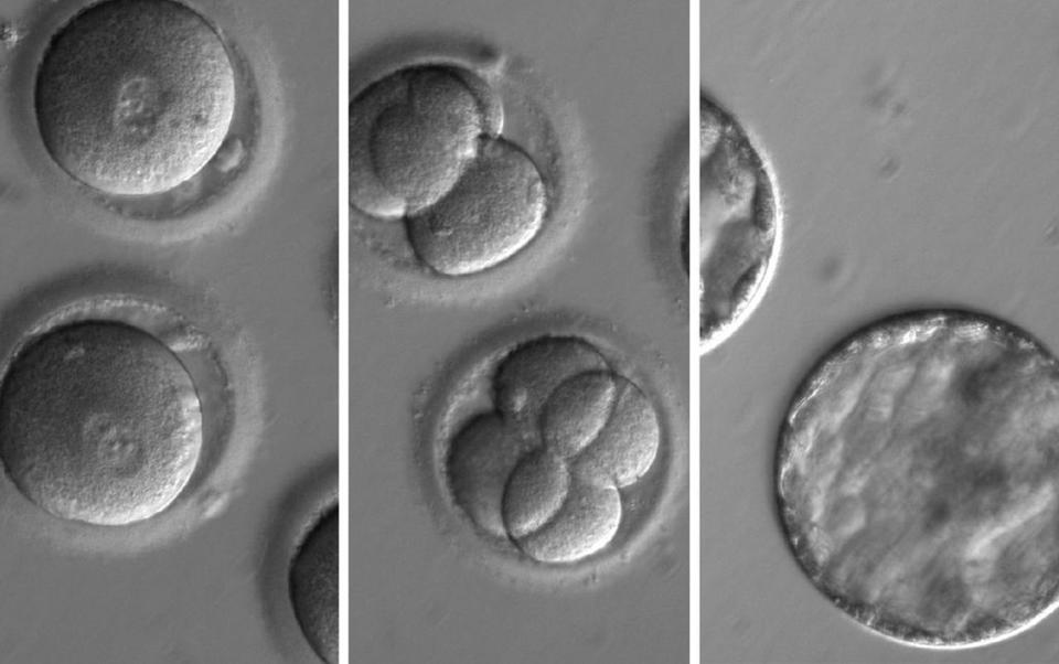  This release comes a day after a team from the US successfully altered the DNA of an embryo to fix a defective heart gene