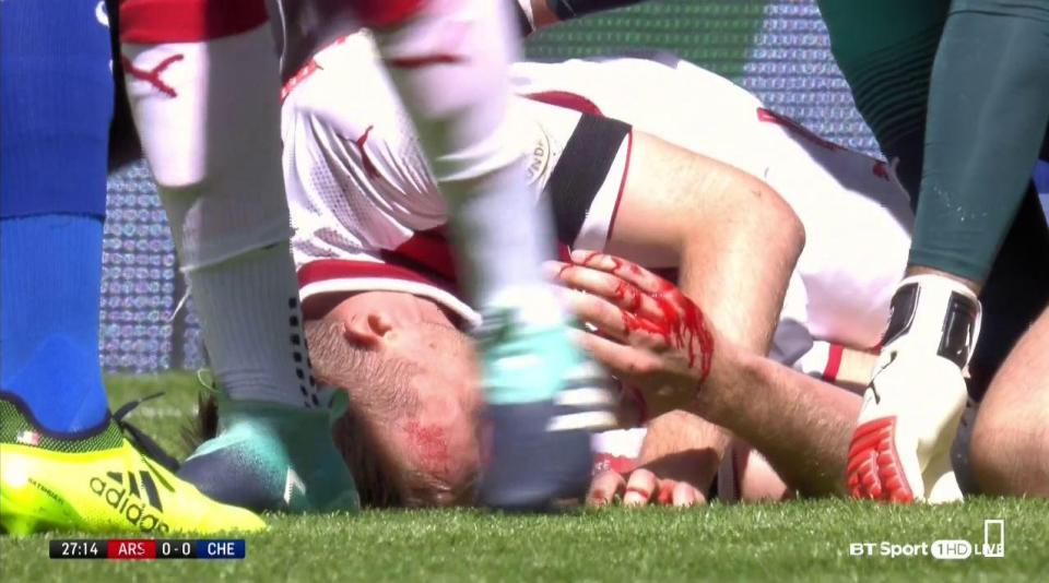  Per Mertesacker was left covered in blood following an elbow from Chelsea centre-back Gary Cahill