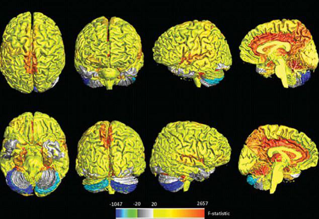  The visual and coordination parts of the brain were more active in men, the study found