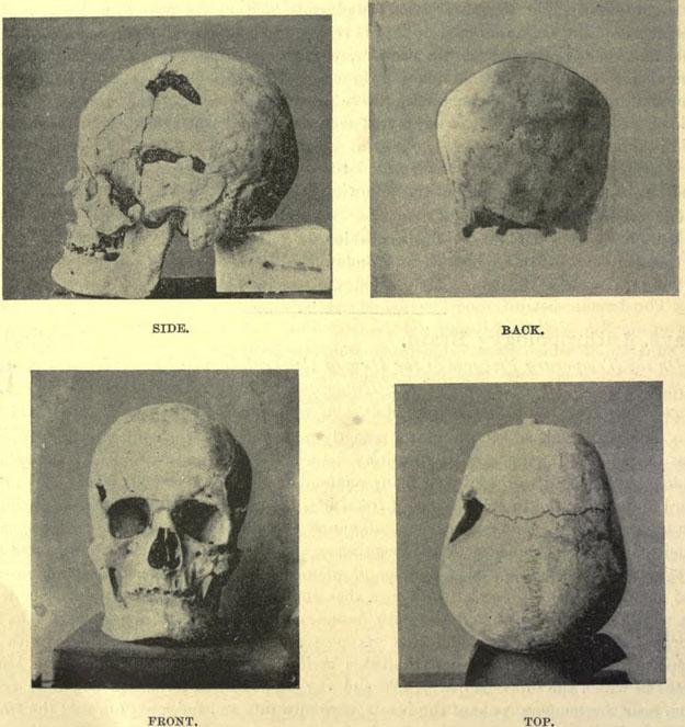  The huge skull found at the site is believed to belong to King Sa-Nakht