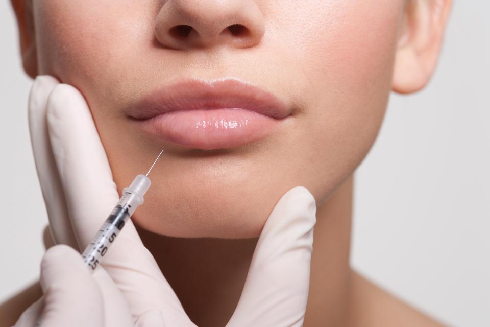  Dermal fillers are injections used to fill out wrinkles and to plump up the volume of the lips and also the cheeks