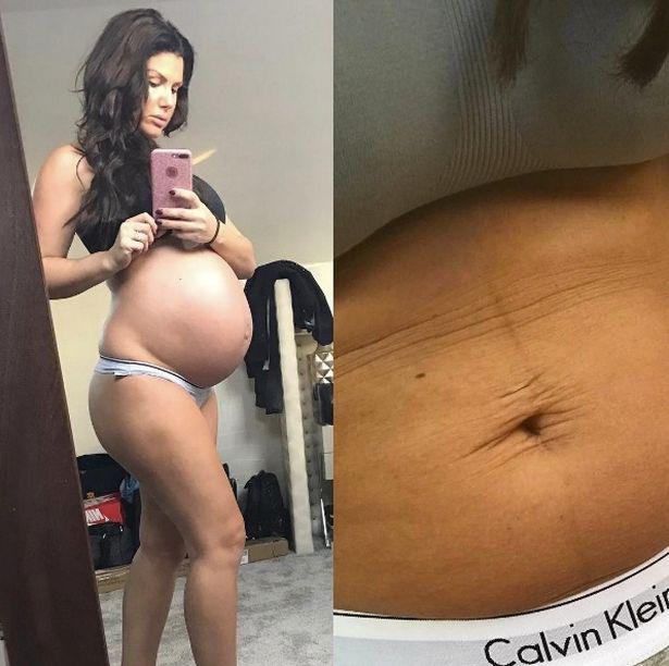  Bumpy ride . . . yummy mummy Rebekah Vardy shares the before and after