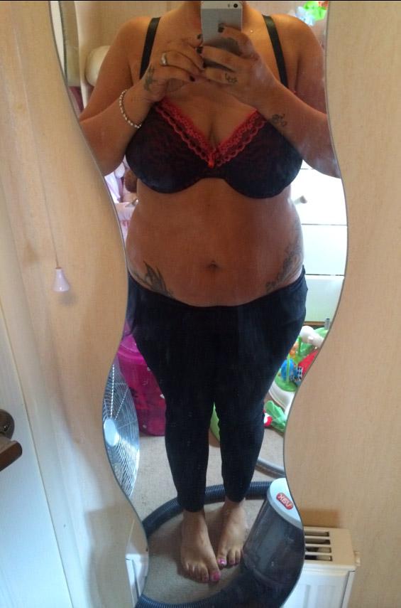  Cassy says that she suffered with swelling in her hands and feet because of her weight, pictured before losing seven stone