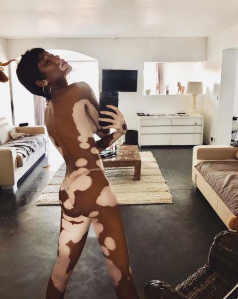  Winnie Harlow showed off her slender curves in a striking nearly-naked Instagram selfie