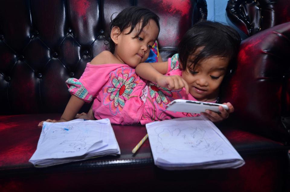  The four-year-old sisters have a fully formed pair of arms each, but only two legs, which means they have to crawl like a spider to get their toys and play