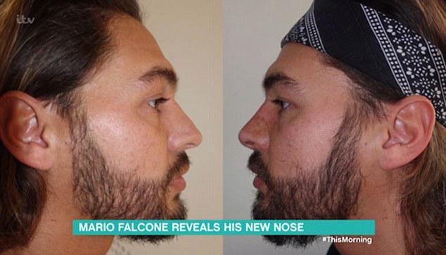  Arg will be going to Dr Frati after Mario Falcone was thrilled with his results last years