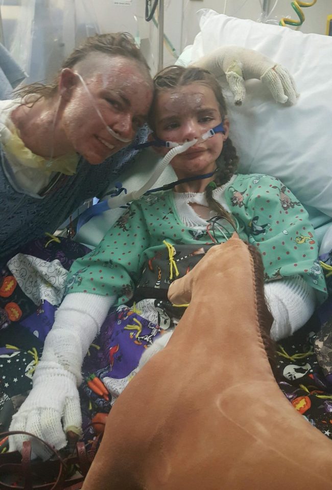  Angel Fiorini and her daughter Gianna suffered horrific burns after a fire raged through their Washington home last October