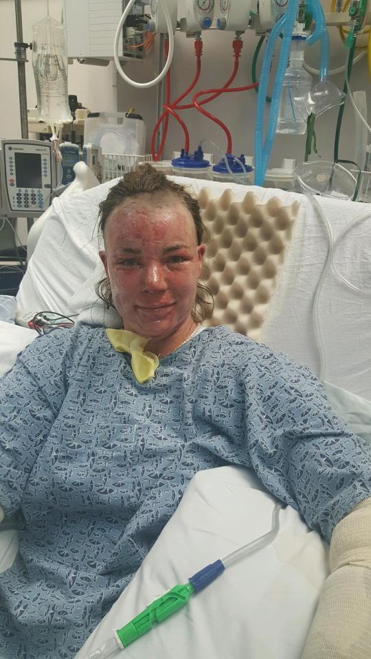  Angel, pictured in hospital in November, sustained injuries on her face, arms and back