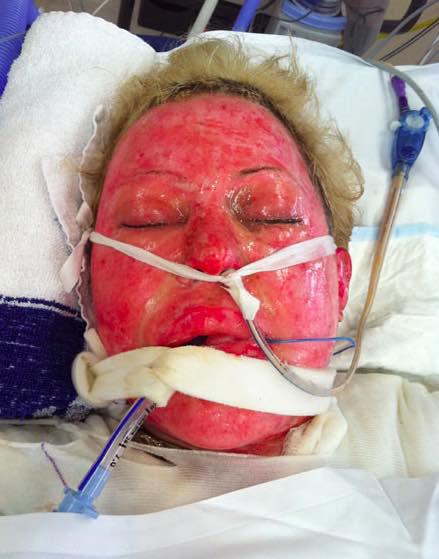  Dana was set on fire by Natalie Dimitrovska, who wrongly accused her of sleeping with her husband