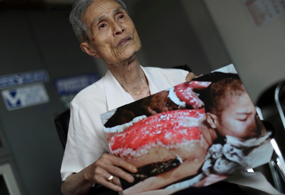  Sumiteru Taniguchi, a survivor of the 1945 atomic bombing of Nagasaki, shows a photo of himself taken in 1945