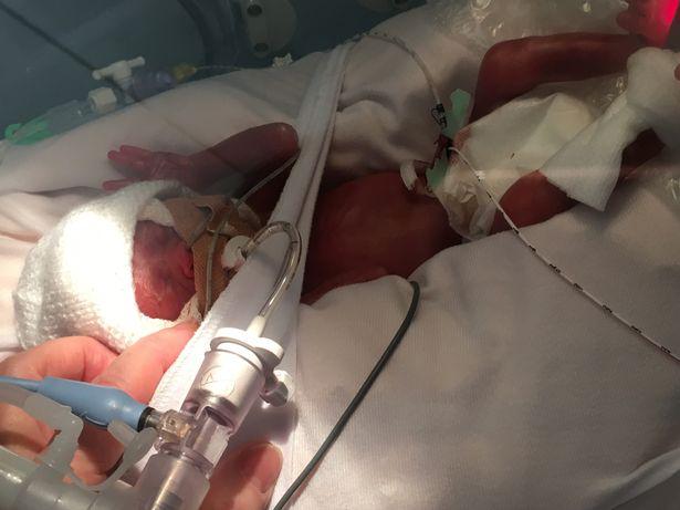  The family said the baby girl had defied the odds