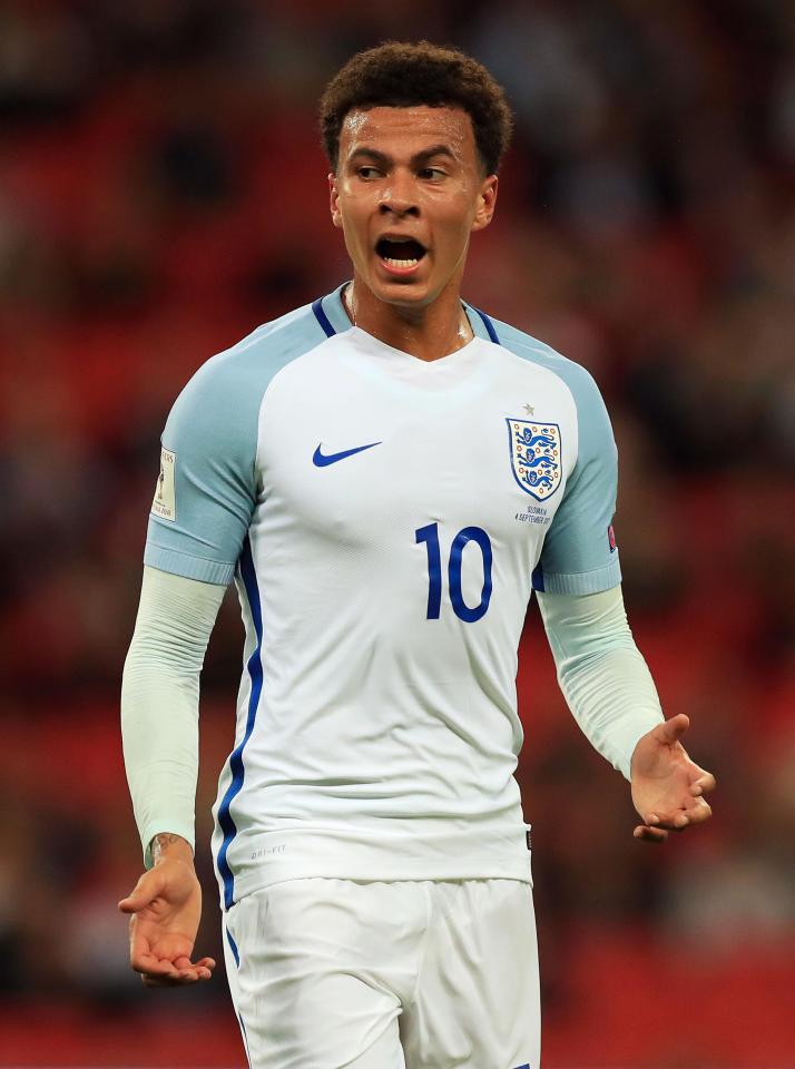  Gareth Southgate will not want Dele Alli to miss the start of next summer's World Cup