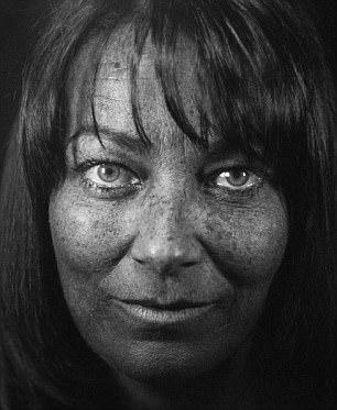 A picture of Terri Dwyer's face under UV light shows the damage and sun spots caused by her frequent use of sunbeds