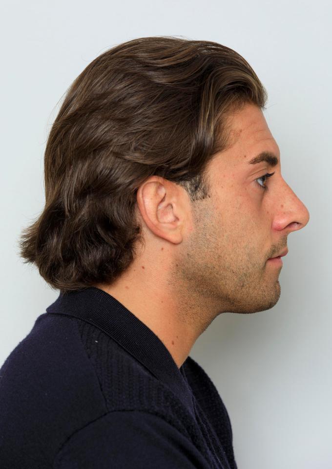  The Essex lad thanked Dr Fratti, who is a favourite to Towie stars for his new nose