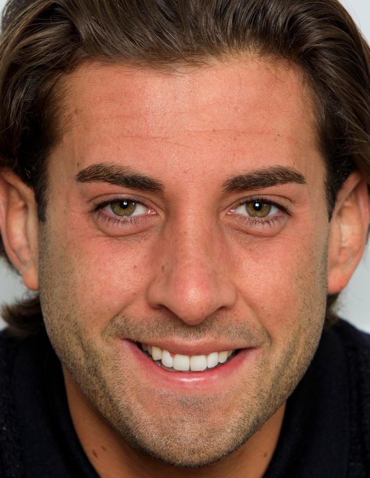  James 'Arg' Argent has revealed his brand new nose following surgery two weeks ago