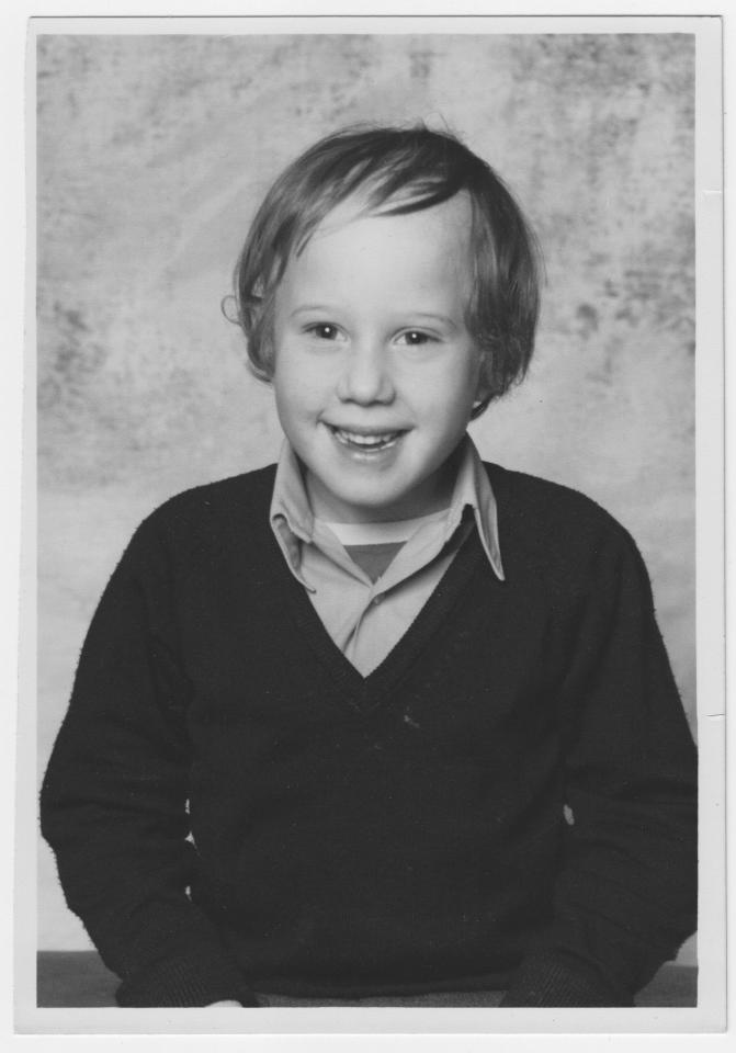  Matt aged six at the start of his hair loss