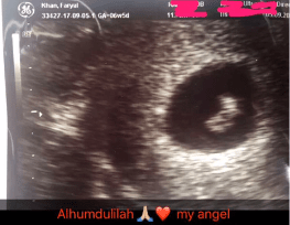 Faryal shared an image of the baby scan on Snapchat with her fans