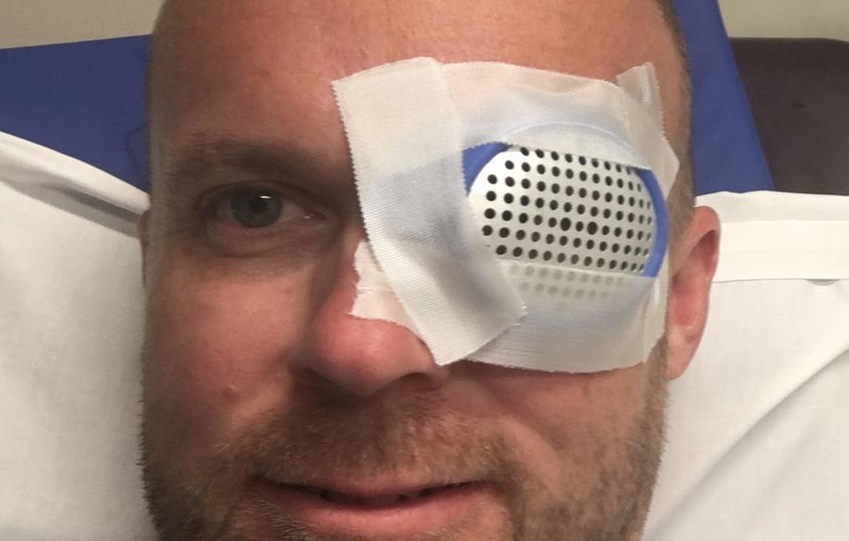  Steve Haddock, from Indianapolis, was left temporarily blind after being shot 20 feet away by his six-year-old son with a a toy Nerf gun