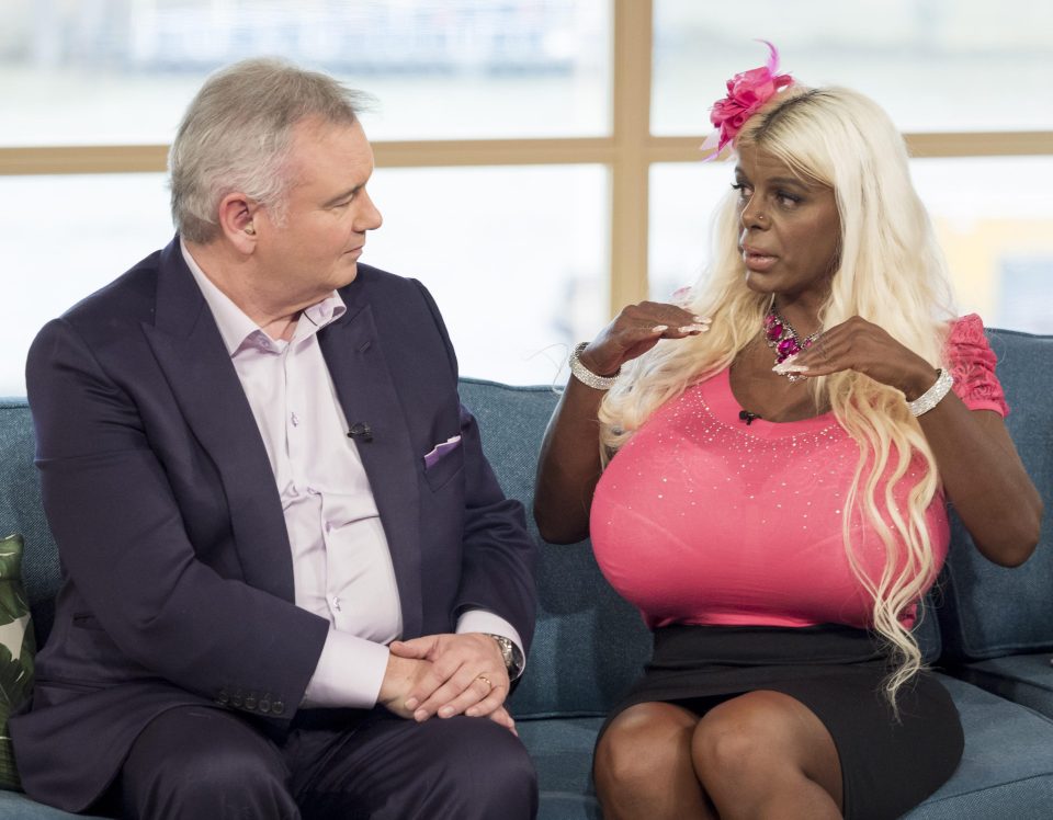  She previously shocked viewers on This Morning with her dramatic appearance - and 32S boobs