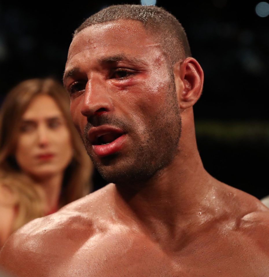 Kell Brook has no opponent lined up since suffering back to back defeats