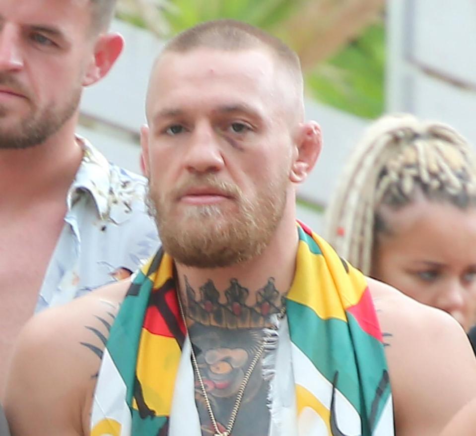 Conor McGregor is in equal spot as Gareth Bale