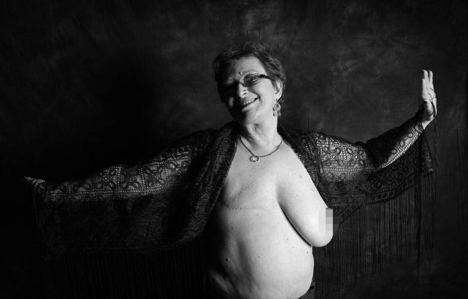 Caroline Harper, 59, from Brancaster, Norfolk, pictured before her second mastectomy