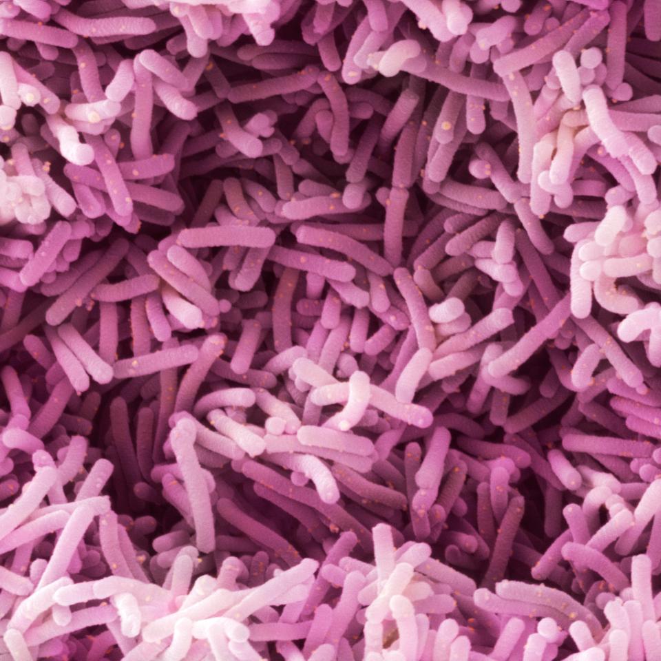  Lactobacillus is a type of probiotic bacteria found in our digestive tracts and genital area