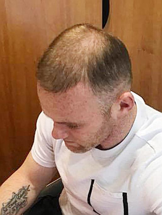 Wayne Rooney appears to be losing his hair again in this recent photograph