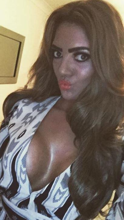  Abbie suffered a fake tan fail earlier this year and says trolls targeted her over it