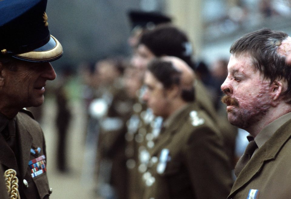  Prince Philip meets Simon and other soldiers wounded in the Falklands War in 1982