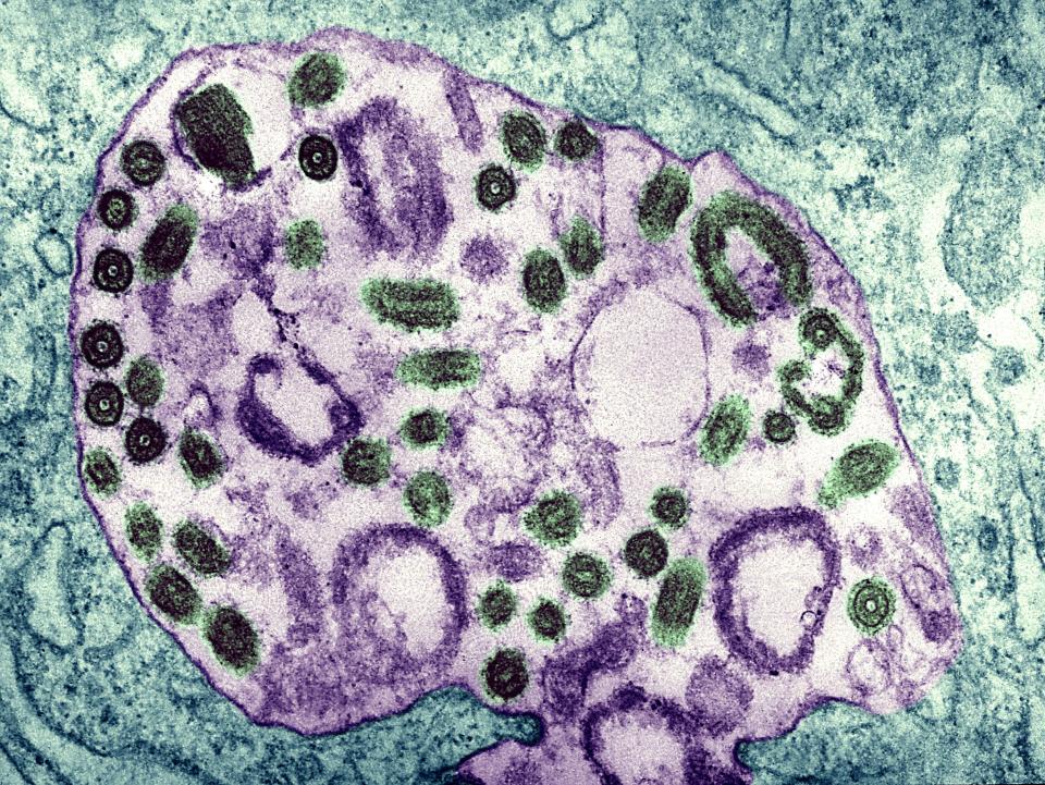 Pictured is a microscopic image of Marburg virus, a pathogen very similar to Ebola