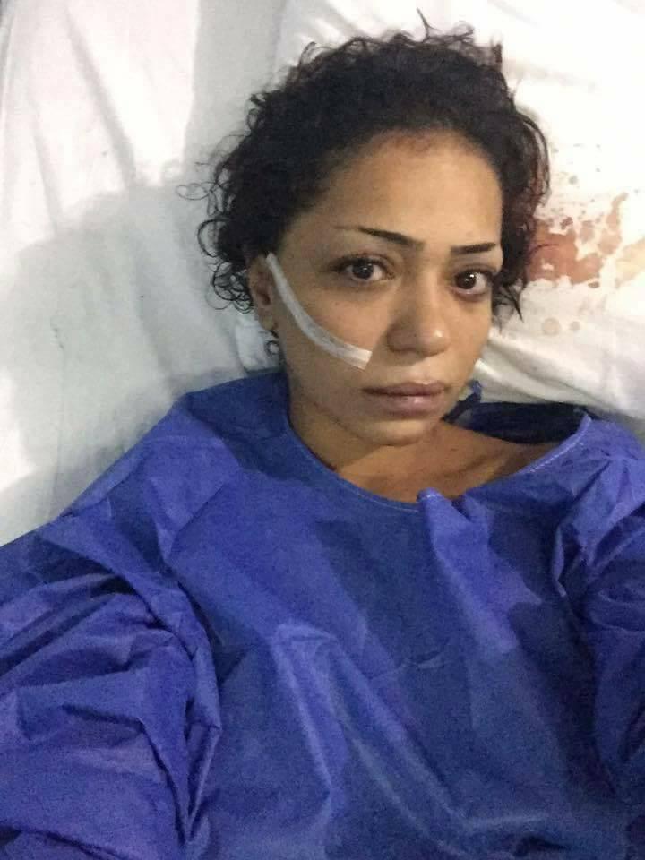 Somaya Ebeid claims the man who physically assaulted her in a Cairo shopping centre two years ago knifed her as revenge for reporting him to police