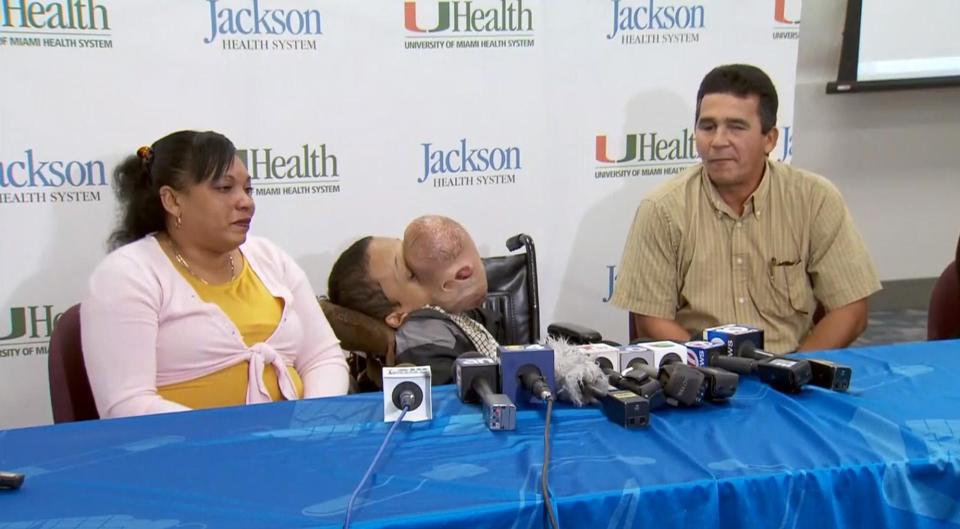  Emanuel's parents travelled with him from their native Cuba on a medical visa for the surgery