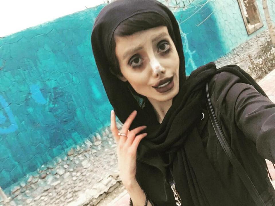  Sahar's shocking photos may have been photoshopped, some people claim