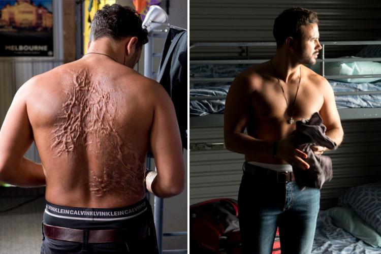 Ryan Thomas is seen with his back covered in scars in the first look at his role on Neighbours