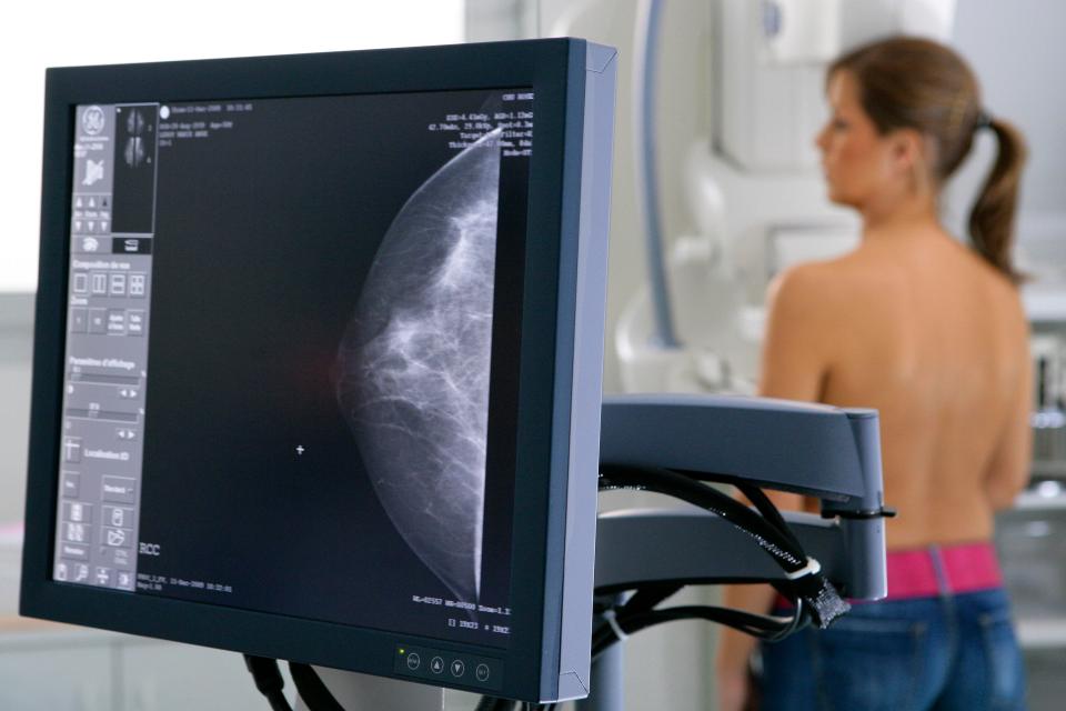  All women over 30 are to be screened which should see a reduction in cancer diagnosis