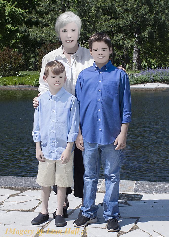  Sons Cade, 12, and Connor, eight, and Dave’s mum Sharon had their features altered beyond recognition