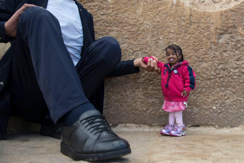  Jyoti Amge, from India, holds the title for world's shortest woman at just over 2 ft tall.