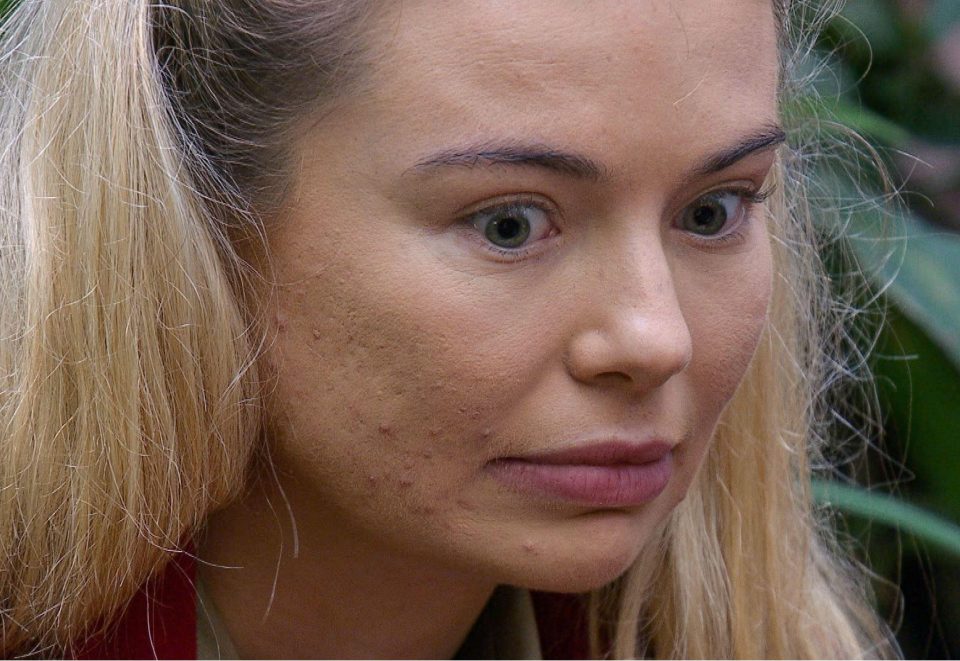 Toff was allowed to take some make-up into the jungle on medical grounds