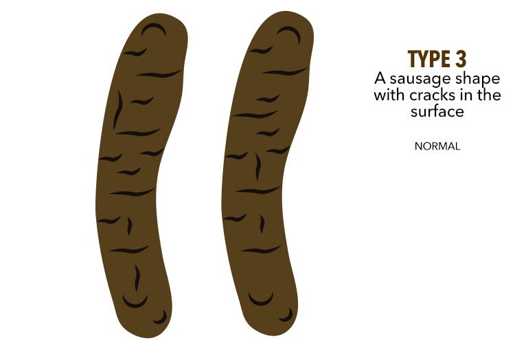 If your poo is sausage shaped with a few cracks then it's a healthy number two