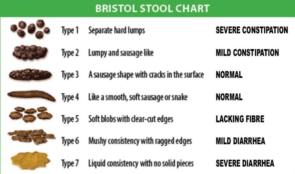 The Bristol Stool Chart indicates what your poo should look like