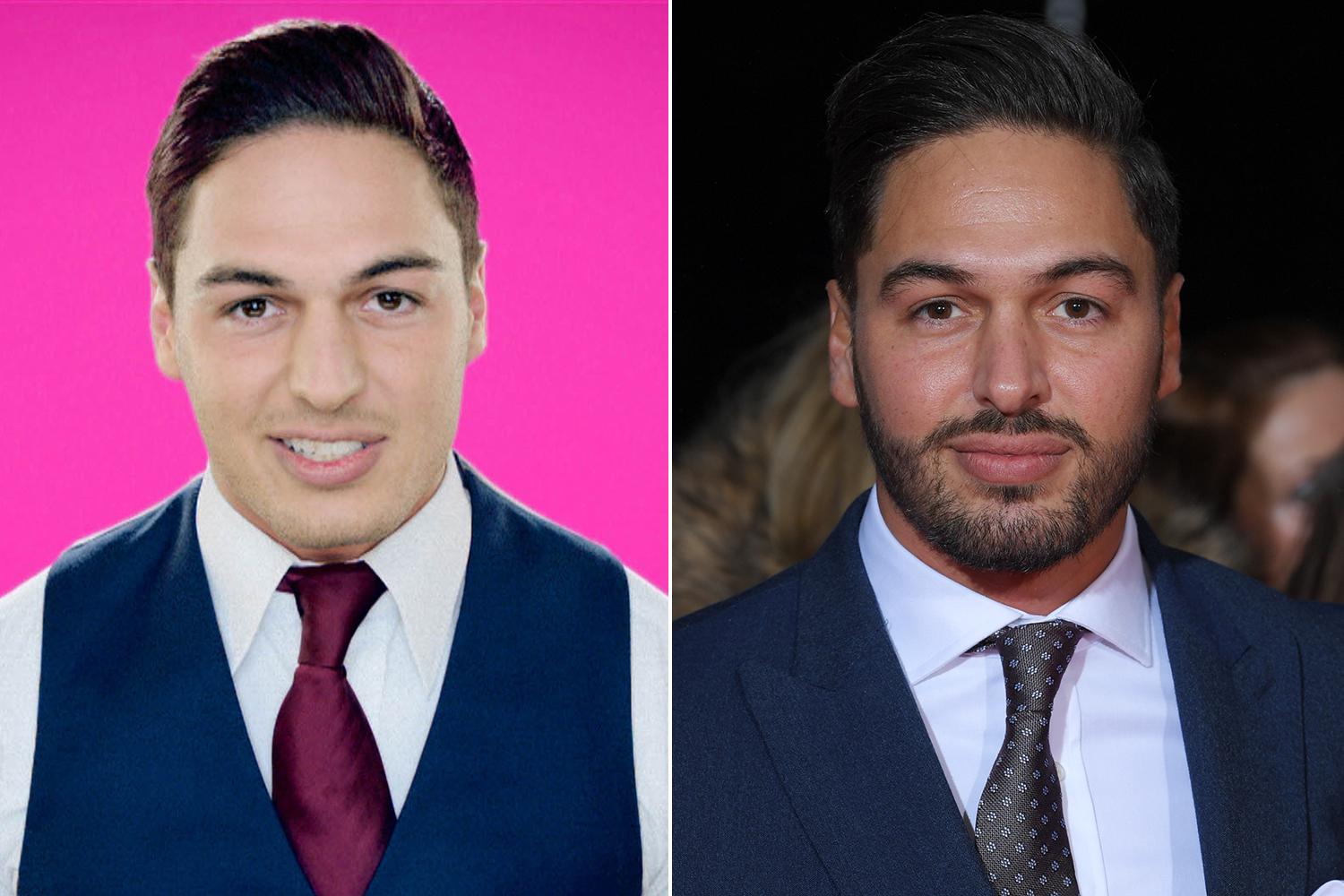 Towie's Mario Falcone before and after the £5,000 surgery