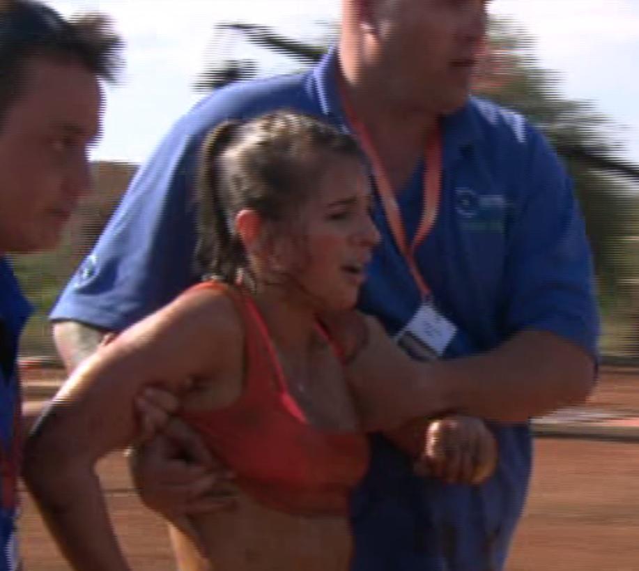  Dani had to leave Survival Of The Fittest after dislocating her shoulder