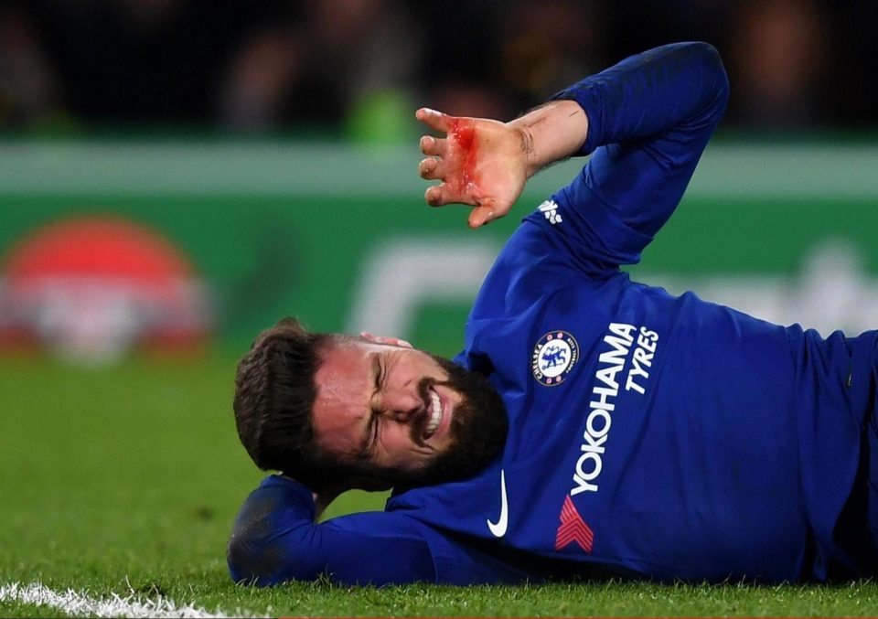  Olivier Giroud with blood on hand from head wound during West Brom win at Stamford Bridge