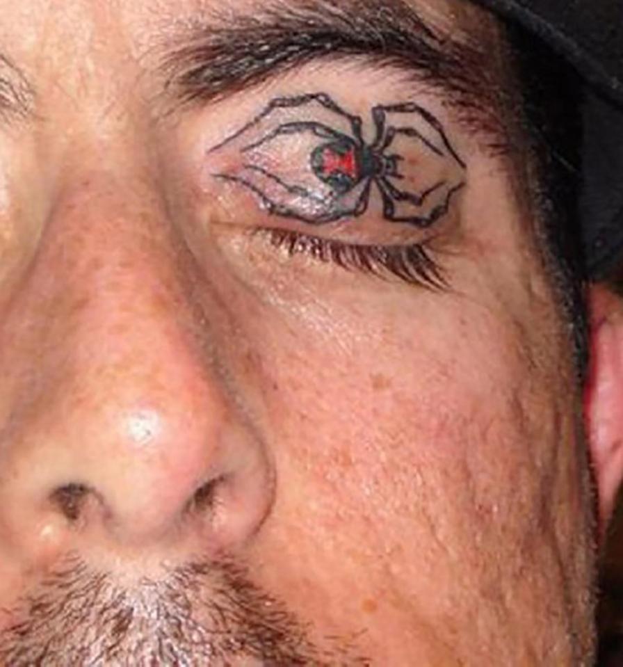 This fella went for a black widow spider over his left eyeball