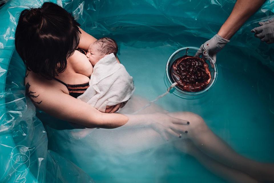 A placenta is fished out of a birthing pool in this stark image 